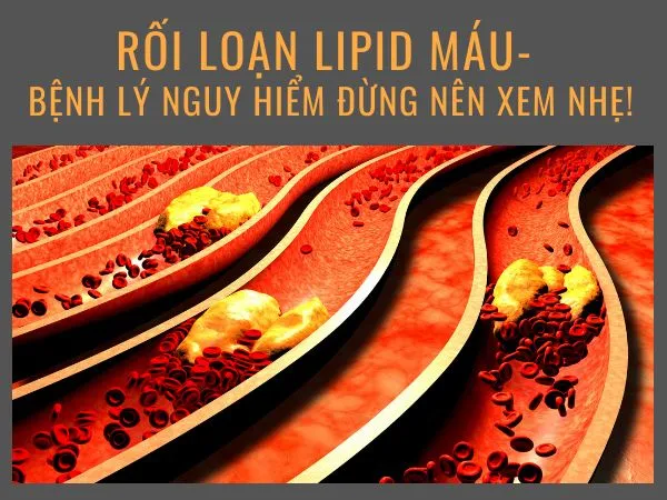 Rối loạn lipid máu - Bệnh lý nguy hiểm đừng nên xem nhẹ!